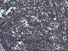 FMR1 / FMRP Antibody (aa36-279, clone OTI5B9)