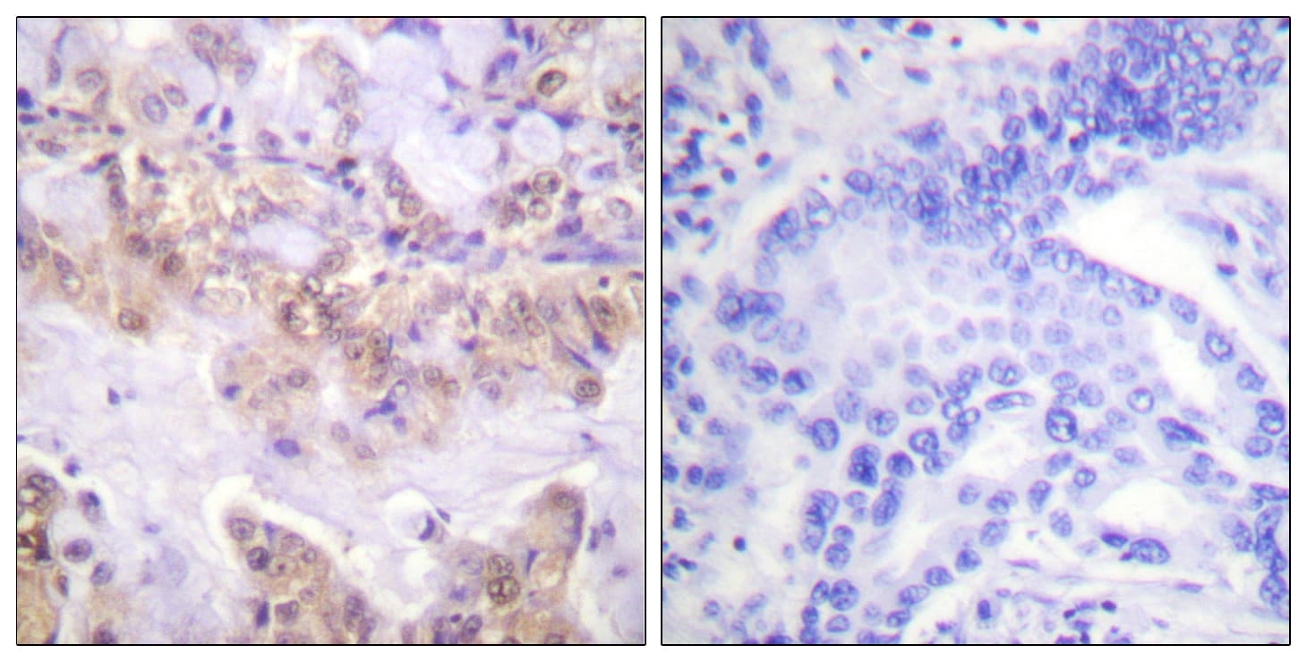 Polyclonal Rabbit anti-Human RAF1 / RAF Antibody (phospho-Ser621, IHC, IF, WB)