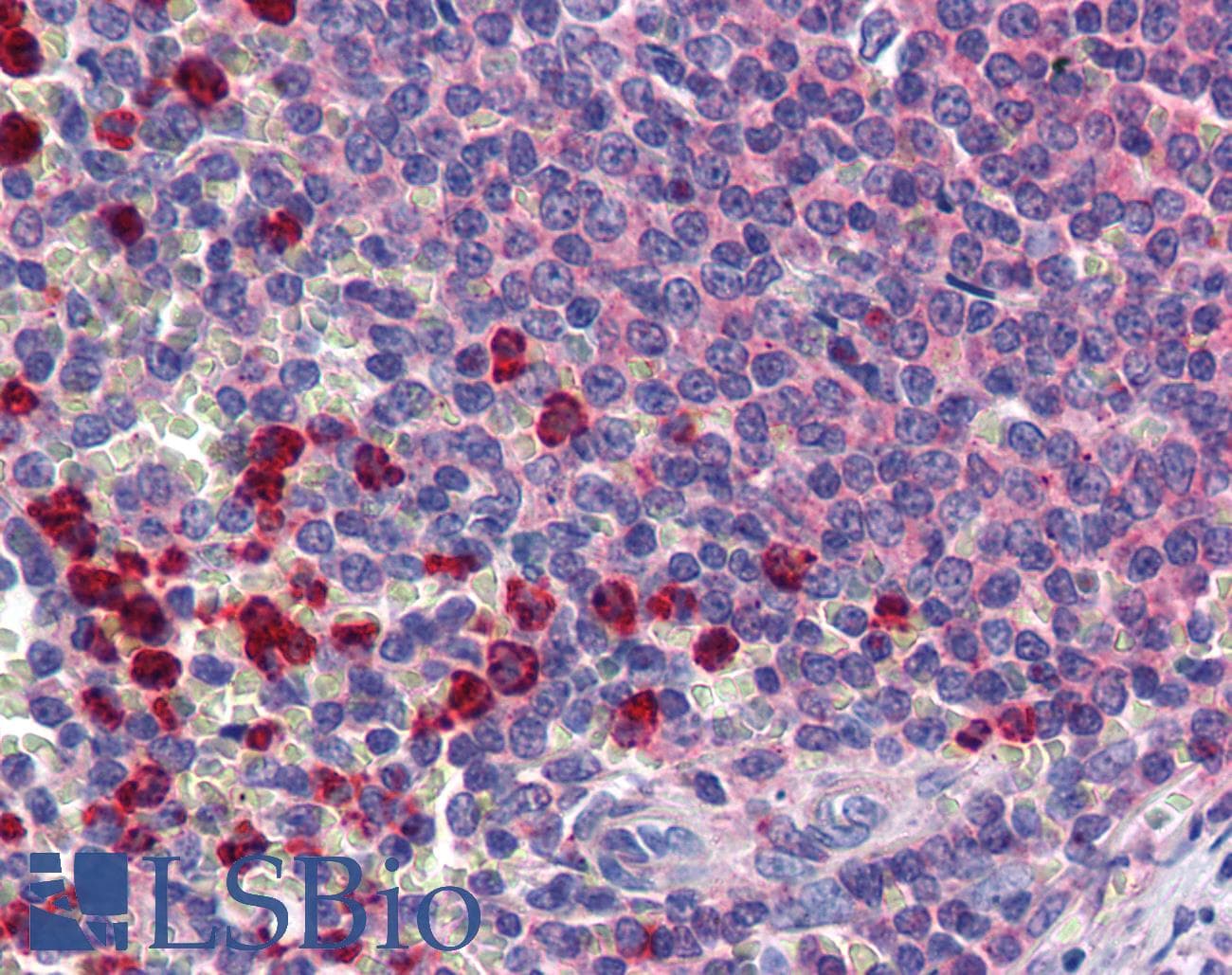 IHC-plus™ CLEC2D / OCIL / LLT1 Antibody (clone 4C7)