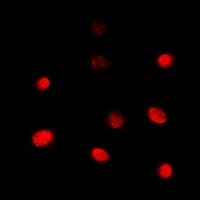 TBX1 Antibody (C-Terminus)
