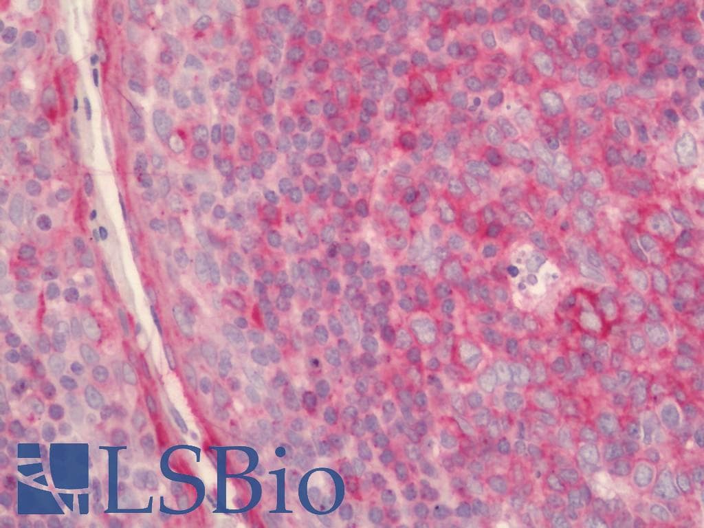 IHC-plus™ Monoclonal Mouse anti-Human HLA-E Antibody (clone MEM-E/02, Concentrated, IHC, WB)