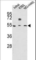 APOA4 Antibody (aa49-79)