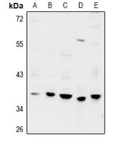 GPRC5D Antibody