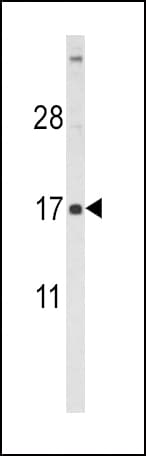 FSHB / FSH Beta Antibody (aa55-83)