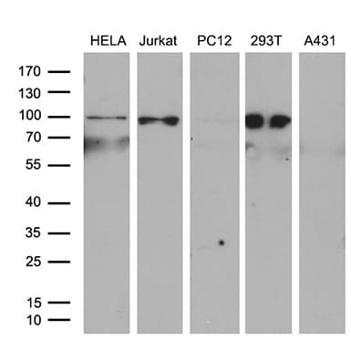 ERCC3 / XPB Antibody (aa191-436, clone OTI6H8)