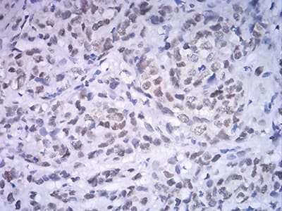 ATF4 Antibody (clone 2A6F12)
