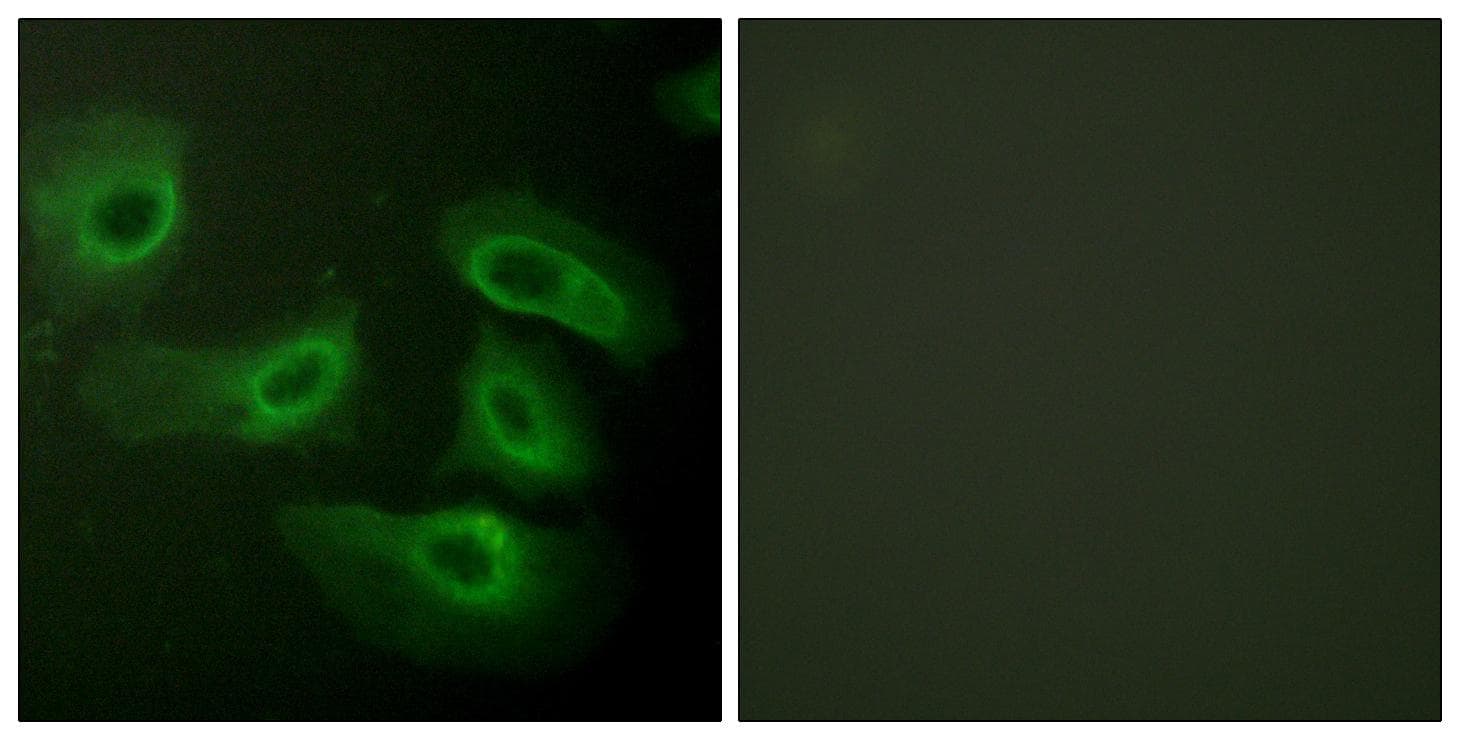 CASP9 / Caspase 9 Antibody (p196)