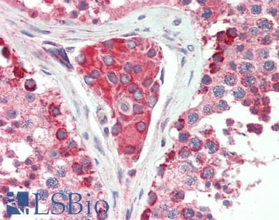 IHC-plus™ FKBP38 / FKBP8 Antibody