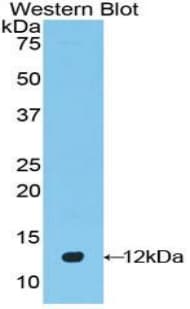 DEFB4A / BD-2 Antibody (aa21-71)