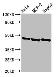 Polyclonal Rabbit anti-Human BFSP2 Antibody (IHC, IF, WB)