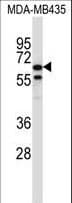 TRIM39 / RNF23 Antibody (aa248-277)