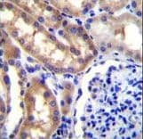 Polyclonal Rabbit anti-Human SH2D4A Antibody (aa38-67, IHC, WB)