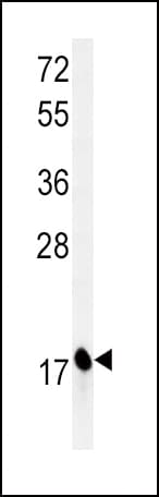 CPLX1 / Complexin 1 Antibody (aa33-60)