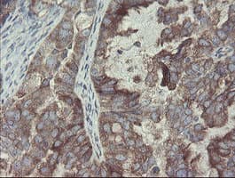 Monoclonal Mouse anti-Human GORAB / SCYL1BP1 Antibody (clone OTI1E3, aa35-394, IHC, WB)