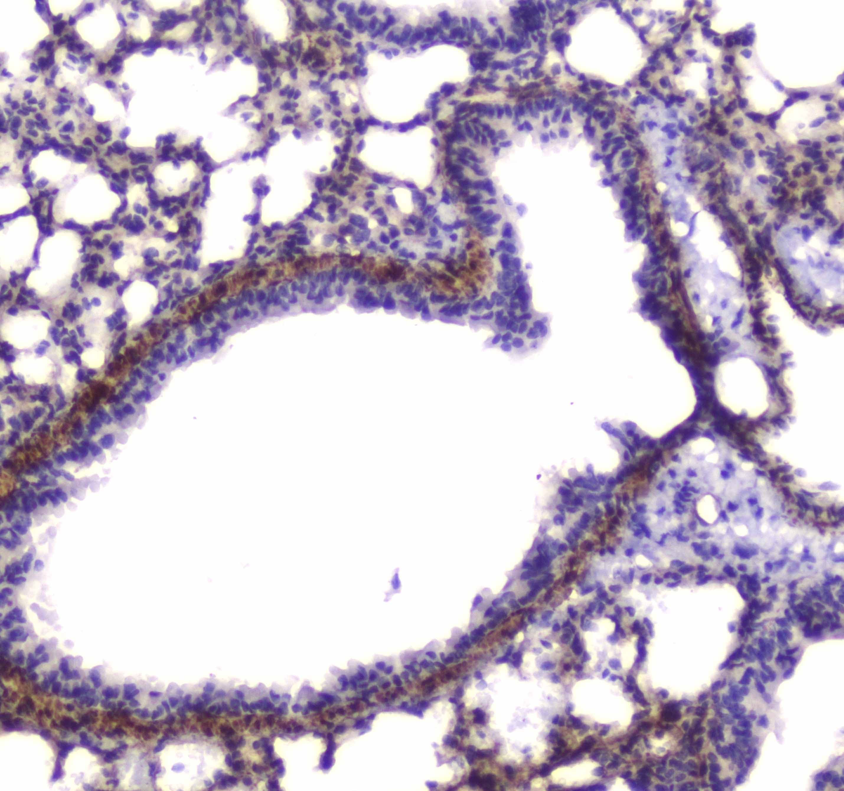 MYLK Antibody
