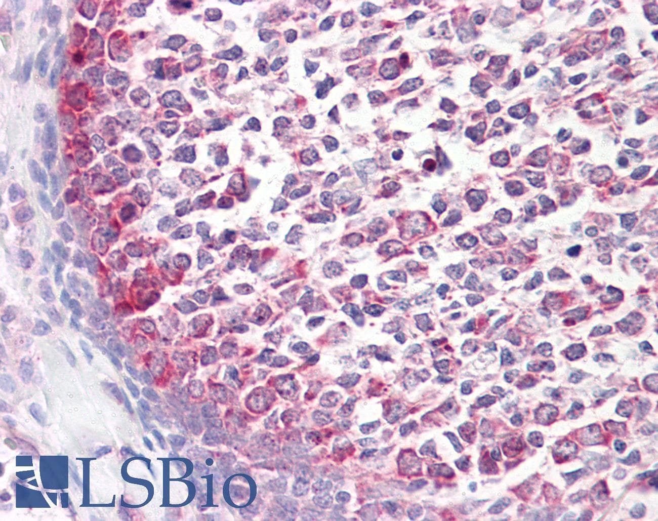 PathPlus™ CASP9 / Caspase 9 Antibody (aa266-315)