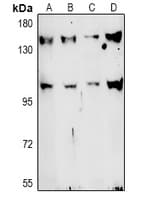 Polyclonal Rabbit anti-Human TAF3 Antibody (WB)