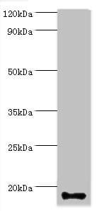IHC-plus™ Polyclonal Rabbit anti-Human CALML5 Antibody (aa1-146, IHC, WB)