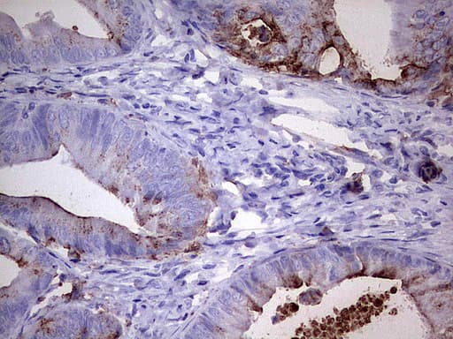 MMP7 / Matrilysin Antibody (aa95-267, clone UMAB168)
