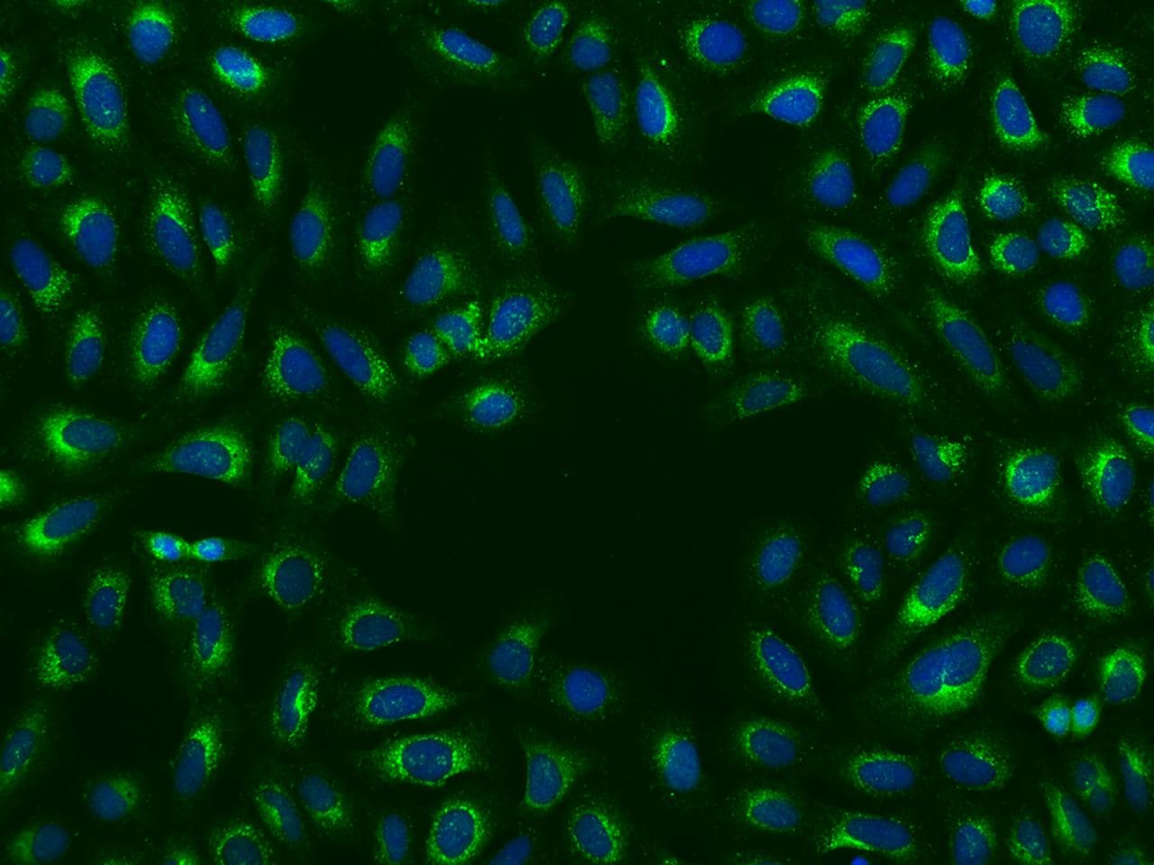 YWHAE / 14-3-3 Epsilon Antibody