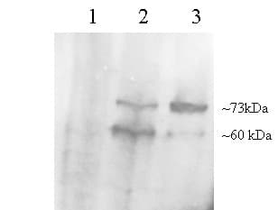 PCSK9 Antibody (aa679-692)