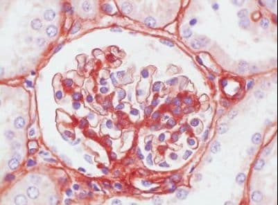Collagen IV Antibody (clone C IV 22)