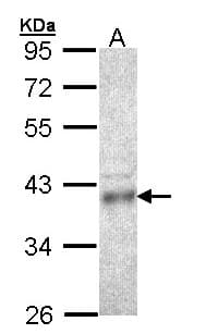 CPOX Antibody (aa139-423)