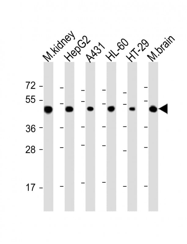 Polyclonal Rabbit anti-Human NDUFV1 Antibody (aa194-226, WB)