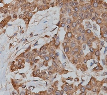 SLC25A13 / CITRIN Antibody