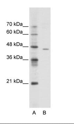 ACCN4 / ASIC4 Antibody (aa121-170)