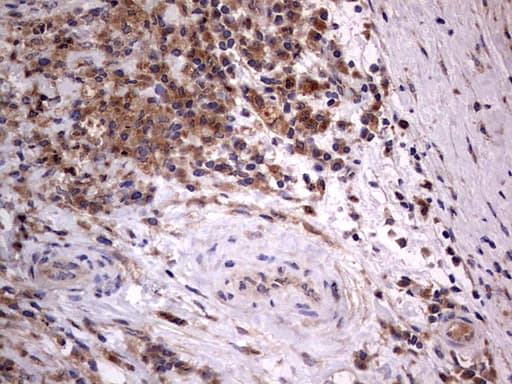 Monoclonal Mouse anti-Human ARAF / ARAF1 / A-RAF Antibody (clone OTI2G9, aa145-365, IHC, WB)