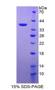 Rat Metallothionein 2 Protein (Recombinant His-GST)