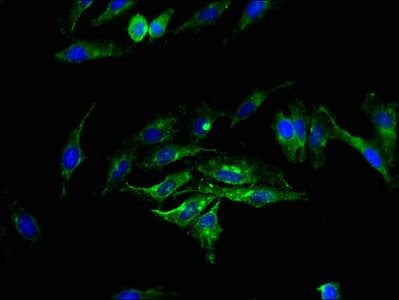 Polyclonal Rabbit anti-Human SMS2 / SGMS2 Antibody