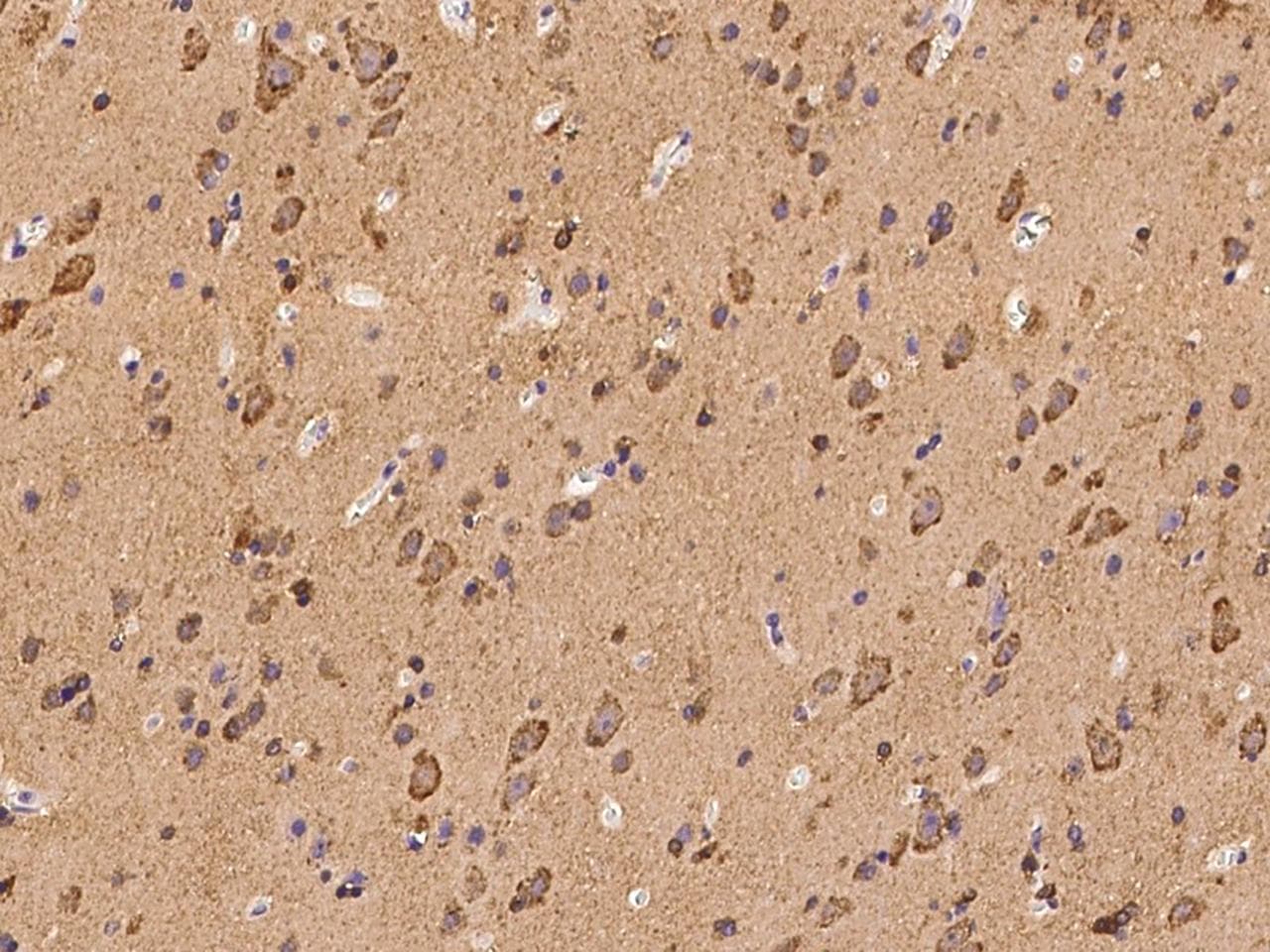Polyclonal Rabbit anti-Human LMX1B Antibody (IHC)