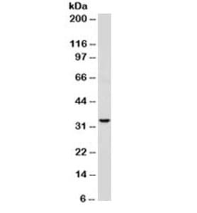 CD74 / CLIP Antibody (clone SPM523)