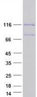 Human RAI14 Protein (Recombinant Myc-DDK (Flag))