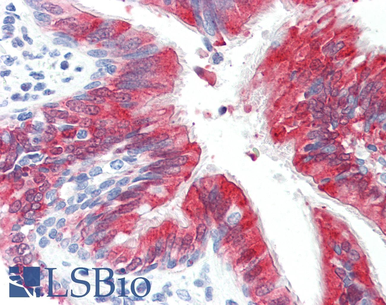 IHC-plus™ Polyclonal Rabbit anti-Human RHOBTB2 / DBC2 Antibody (aa61-110, IHC, WB)