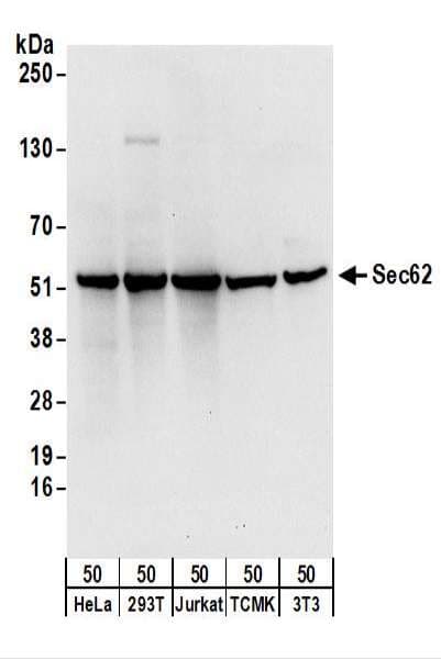 SEC62 / TP-1 Antibody (aa349-399)