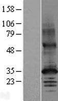 SLC30A2 Protein (Over-Expression Lysate Myc-DDK (Flag))