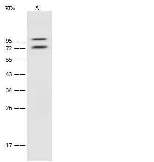 COMP / THBS5 Antibody