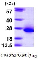 Human C6orf108 Protein (Recombinant His)