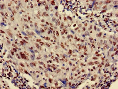 HIST1H3A Antibody