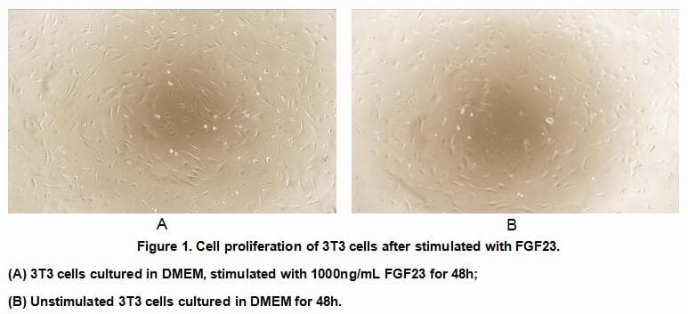 Mouse SOCS3 Protein (Recombinant His, N-Terminal)