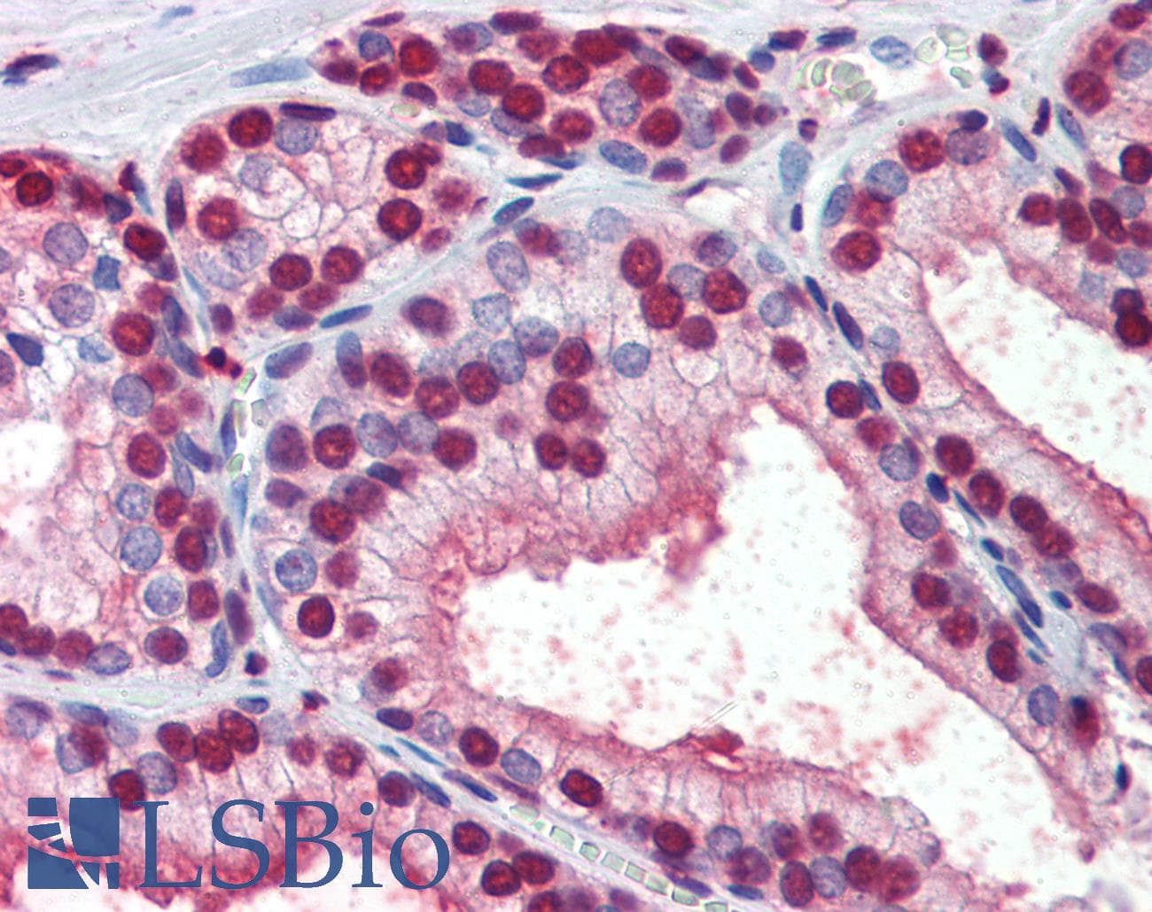 IHC-plus™ Monoclonal Mouse anti-Human CRABP1 / CRABP Antibody (clone AT1A1, IHC, WB)