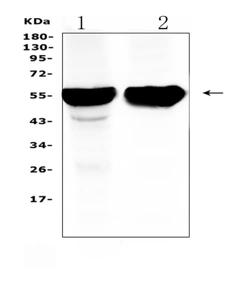 Polyclonal Rabbit anti-Human CYP2D6 Antibody (IHC, WB)