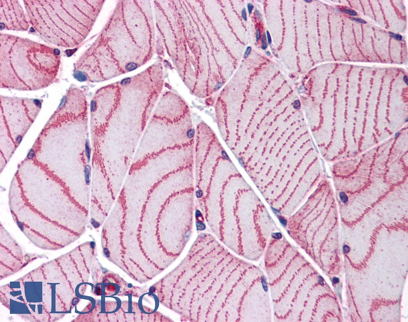 IHC-plus™ ACTN2 Antibody