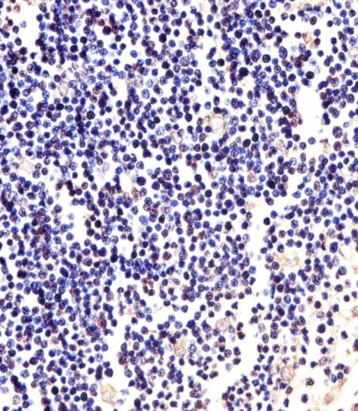 ANAPC2 / APC2 Antibody (aa712-746)