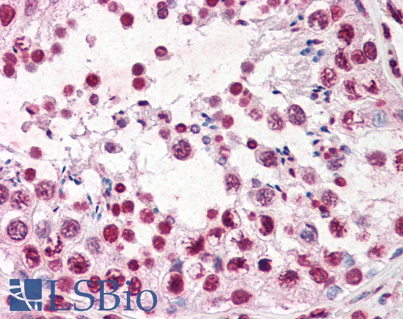 IHC-plus™ ERCC3 / XPB Antibody (aa242-261, clone 3G4)