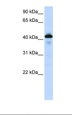 Polyclonal Rabbit anti-Human SFTPB / Surfactant Protein B Antibody (aa194-243, IHC, WB)