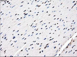 IHC-plus™ Monoclonal Mouse anti-Human AKR1A1 Antibody (clone 10E11, IHC, WB)